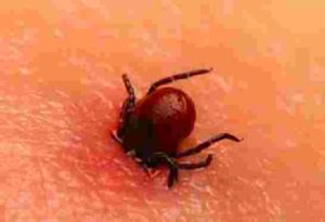 Tique pénétrant dans la peau, maladie de Lyme